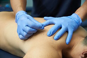 fisioterapia fisioterapia